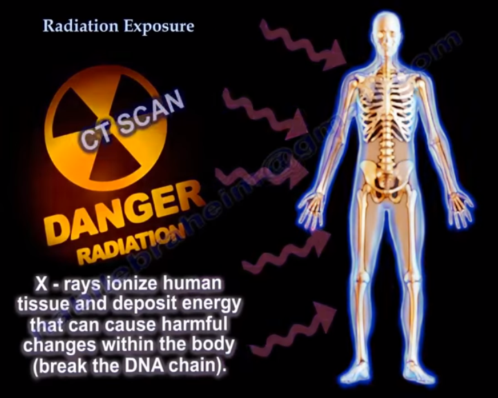 放射診療領(lǐng)域眼晶狀體劑量 放射診療領(lǐng)域眼晶狀體劑量